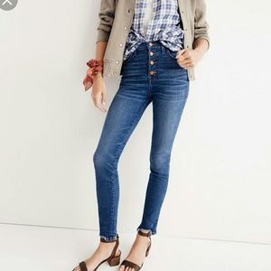 Madewell Button Through Edition Chewed Hem 26
